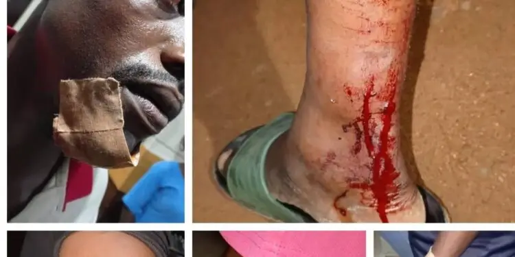 Panic As 5 Hospitalized In Ekiti Over Stray Bullets